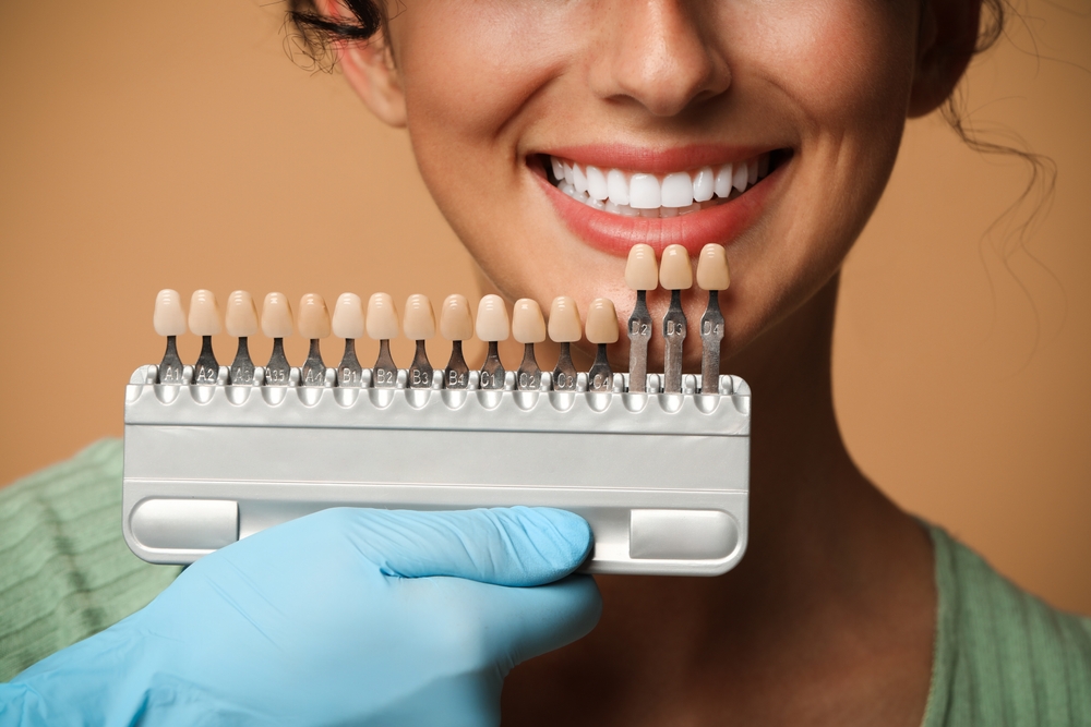 how to choose the right colour and shape for your veneers