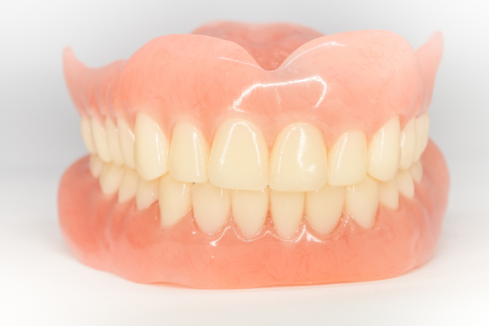 dental bonding in south edmonton