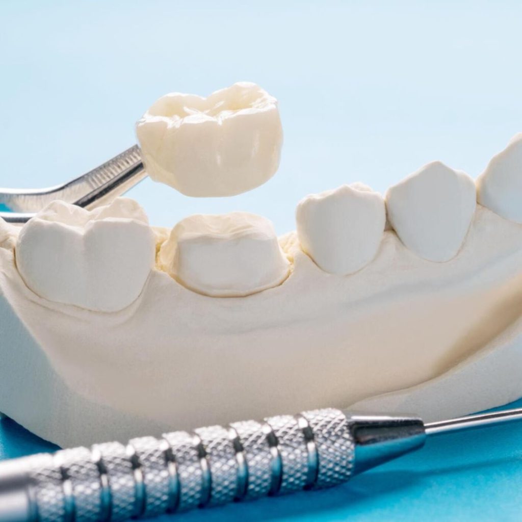dental crowns near you