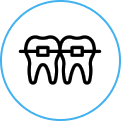 Early Orthodontic Intervention